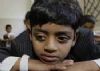 'Slumdog...' fame kid's father dies of tuberculosis